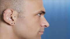 男人耳朵有痣代表什么